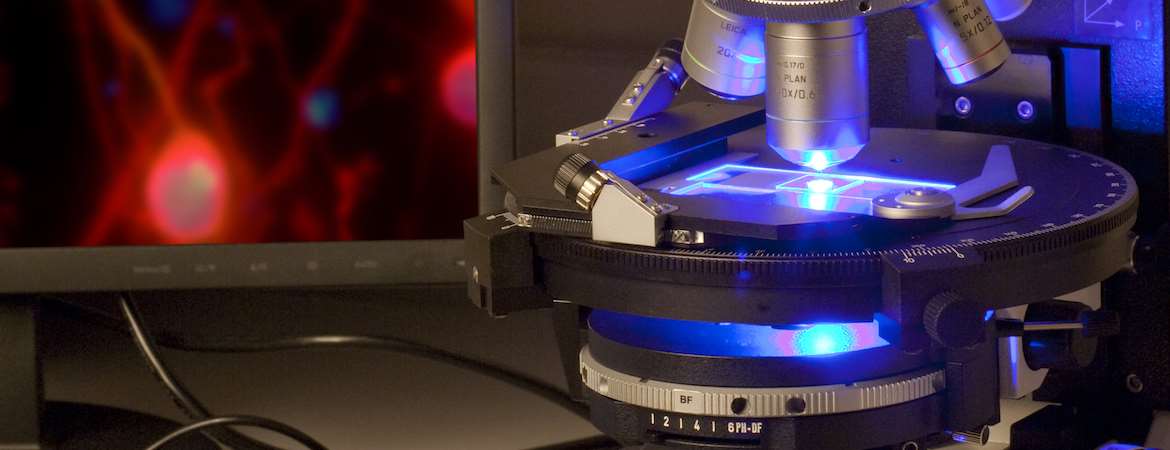 An optical microscope on the left with a laser beam passing through the stage and a monitor with fluorescent image on the right. 